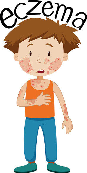 Eczema: 7 Mom-tested remedies